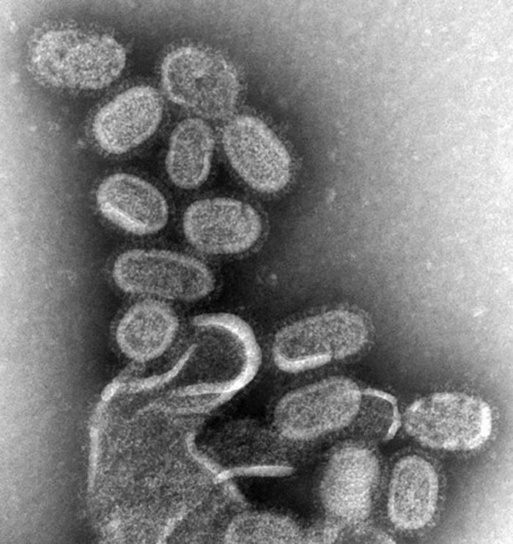 Virions grippaux (Myxovirus influenza) quittant leur cellule hôte grossis cent mille fois © Cynthia Goldsmith Content Providers(s)- CDC Dr. Terrence Tumpey