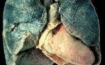 Cigarettes : Prix augmenté de 6%