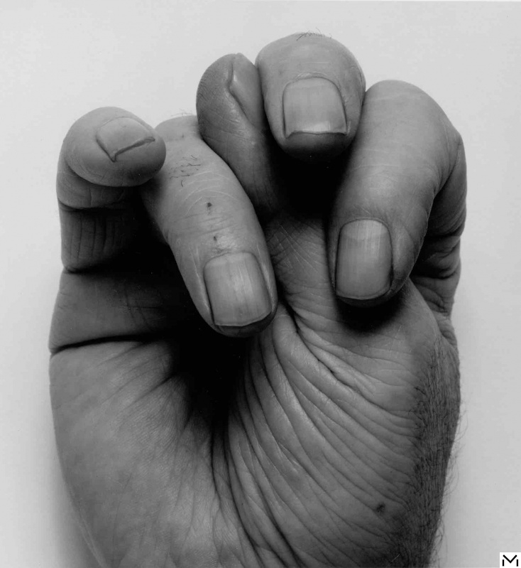Front Hand, Thumb Up, Middle, 1998 © The John Coplans Trust
